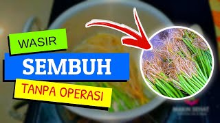 OBAT WASIR PALING AMPUH❗ Cara Mengobati Ambeien Secara Alami Tanpa Operasi [upl. by Varden]