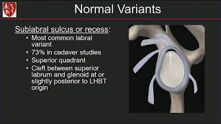 Imaging of the Glenoid Labrum Location Matters By Michelle Nguyen MD [upl. by Eeryk]