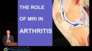 The Roles of MRI in Arthritis  Clyde Helms MD [upl. by Noraha282]