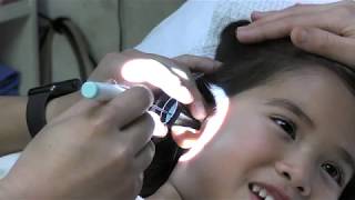 Awake Ear Tube Placement In Children [upl. by Eppie]