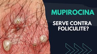 POMADA MUPIROCINA SERVE CONTRA FOLICULITE  DESCUBRA [upl. by Garbers]