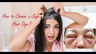 How to Choose a Safe Hair Dye  DrKUma Maheswari MDDVL SMC Slim amp Shine [upl. by Junie776]