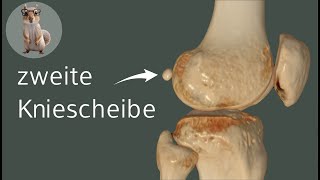 Die zweite Kniescheibe  die Fabella anatomie medizin anatomy [upl. by Nilreb205]