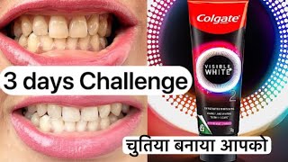 Colgate Visible White 02 Toothpaste Review Get Whiter Teeth in 3 Days Exposed [upl. by Ob]