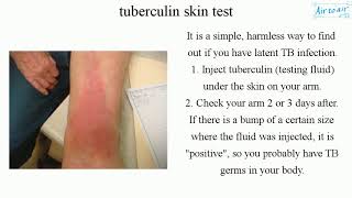 tuberculin skin test English  Medical terminology for medical students [upl. by Noyek]