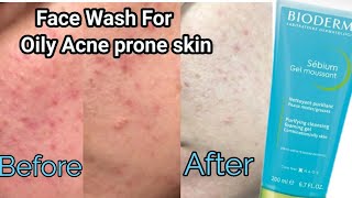 Face wash for Acne Control amp Acne Bioderma sebum Gel Moussant Cleanser for oily amp Acne prone skin [upl. by Abramson784]