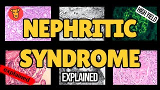 NEPHRITIC SYNDROME Pathogenesis of glomerular injury Mechanism of clinical symptoms USMLE Nephrology [upl. by Ainot170]