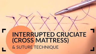 Interrupted Cruciate Cross Mattress Suture Technique [upl. by Rosner]