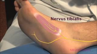 Motorische Neurographie  Tibialis [upl. by Qerat]