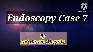 Endoscopy Case 7 httpsyoutubecomchannelUCaFBRNNQOikWUMjiHP4qneQ [upl. by Tenaej]