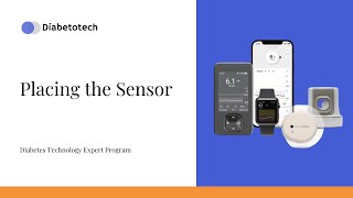 Diabetotech  Dexcom ONE Plus Placing the Sensor  Diabetes Technology Expert Program [upl. by Yssirc]