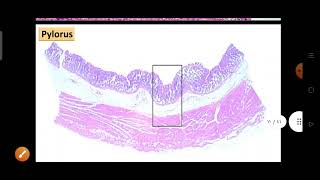 Practical of fundus amp pylorus [upl. by Teerell377]