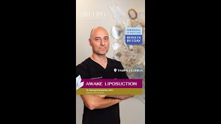 360° Awake Liposuction at ArtLipo  FREE Virtual Consultation [upl. by Ehcrop141]