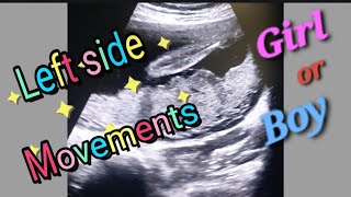 Posterior Placenta With Fetal Heartbeat 130bpm  Left side Baby Movement  27Weeks Baby Genderreveal [upl. by Spillihp]