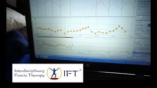 Was ist das Herzratenvariabilitätstraining HRVTraining [upl. by Chrystal229]