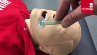 Nasopharyngeal Airway Insertion [upl. by Weider]