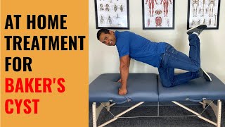 4 Self Treatments For Baker’s Cysts In The Knee [upl. by Dowlen]