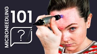 How to MICRONEEDLE 101 Answering Microneedling Pen Questions [upl. by Carlin]