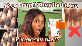 WHY KOJIC SAN SOAP IS NOT WORKING FOR YOU  HOW TO SPOT THE FAKE  Do’s amp Don’t [upl. by Samp]