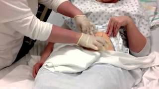 Colostomy Care Teaching Video [upl. by Tews152]