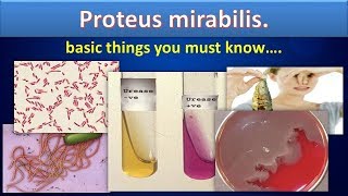 Proteus mirabilissimply clear overviewProteusmirabilisMicrobiologyMLS [upl. by Aniraz]