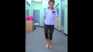 Spiral Thigh Brace for Pigeon Toe Correction [upl. by Clava]