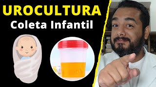 Urocultura em crianças e bebês como fazer a coleta de urina  cultura de urina [upl. by Tarabar]