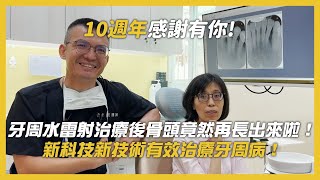 牙周水雷射治療後骨頭竟然再長出來啦！牙齒搖晃新科技新技術有效治療牙周病！ [upl. by Diandre]