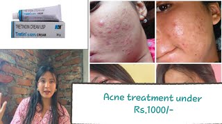 Tretinoin Me amp Acne Night Skin care acne treatment ✅ [upl. by Beaufort]