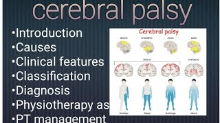 Cerebral palsy datails easy notes PT Neuro  Assessment amp Management  important topic📝 [upl. by Alysa]