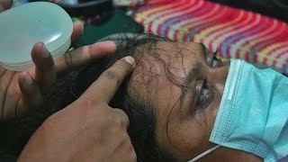 Lice Popping Sounds  Picking Lice From Head [upl. by Seys]