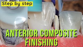 finishing anterior composite step by step [upl. by Kieran]