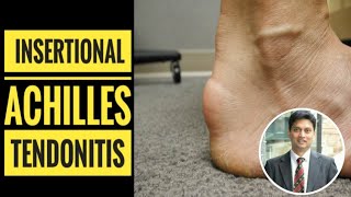 Insertional Achilles Tendinitis How to Diagnose [upl. by Llerdnam278]