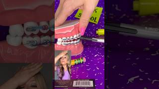 Worst BRACES HABITS 🦷 Orthodontist Reacts Bad Habits for Teeth Satisfying Crunchy Food ASMR [upl. by Sherborn]