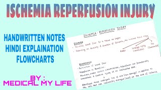 Ischemia Reperfusion Injury [upl. by Ahsek]