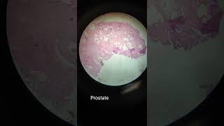 Histopathological slides under microscope [upl. by Isidro]