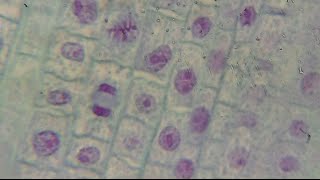 Onion Root Tip Mitosis  Mr Pauller [upl. by Sillert]