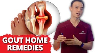 Relief Fast 6 Home Remedies For Gout [upl. by Heidie]