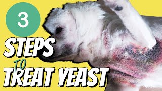 Top 3 Steps to Stop the Itching caused by Yeast [upl. by Pinchas]