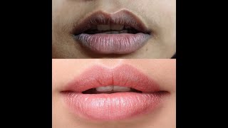 Get Pink Lips in just 5 Minutes Turn Black Lips Pink Naturally [upl. by Ayotnahs738]