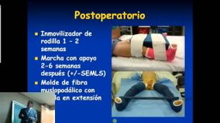 Manejo Ortopédico del paciente ambulatorio con PCI extremidades inferiores [upl. by Mellitz]