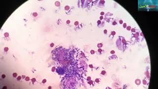 leishmania under the microscope  leishmaniose  الليشمانيا [upl. by Nosmas521]