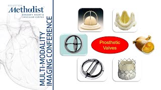 Evaluation of Prosthetic Heart Valves with EchoDoppler Role of CTMRI Zoghbi Chang Shah5322 [upl. by Pembrook25]