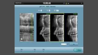 PANORAMICO TOMOGRAPHY IMAGING SYSTEM [upl. by Tenn]