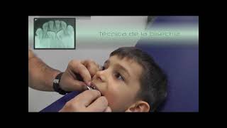 Toma de radiografía periapical de dientes deciduos anteroinferiores con la técnica de la bisectriz [upl. by Rausch550]