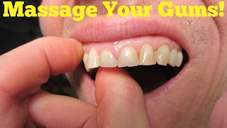 Gum Disease Treatment Natural Remedies MASSAGE YOUR GUMS [upl. by Aonehc26]