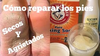 COMO REPARAR LOS PIES SECOS Y AGRIETADOS [upl. by Nailij801]