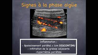 Maladies Inflammatoires Chroniques de lIntestin  2 Crohn amp Rectocolite Hémorragique [upl. by Nahtannhoj]