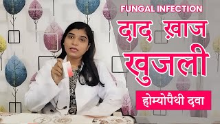 Skin Diseases II Fungal Infections II types II Dr Bharti Patel II दाद खाज खुजली [upl. by Peisch205]