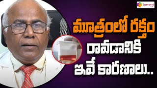 Causes Blood In Urine In Telugu  CL Venkat Rao Health Video  Sreeni TV [upl. by Shem962]